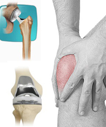 treatments for sports injuries in andhra pradesh, ligament injury treatments in andhra pradesh, ligament surgery treatments in andhra pradesh, torn ligament treatments in andhra pradesh, torn ligament Surgery in andhra pradesh, torn ligament Treatment & Recovery Time in andhra pradesh, meniscal tear treatments in andhra pradesh in andhra pradesh, Torn Meniscus Symptoms  in andhra pradesh, Surgery treatments in andhra pradesh, Treatment & Recovery Time in andhra pradesh